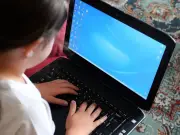 Doctors warn of skin condition in children from device heat