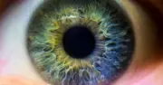 Eye condition cases predicted to soar by 24% as experts warn of surge