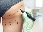 MPs warn cosmetic procedure delay prolongs patient safety risk