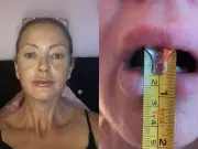 Mum with jaw opening smaller than 5p coin fears NHS 'leaving her to die'