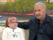 Souness fights tears over 'Devil' skin condition on GMB