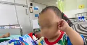 Thai hospital apologises after nurse cuts off child's finger