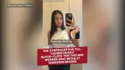 Trainee perfusionist's bruises were blood clots from contraceptive pill