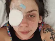 Woman's 'hangover' blurry vision turned out to be eye tumour