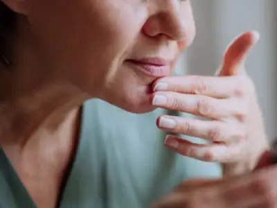 £10 LipQ balm ends 50 years of cold sores for 67-year-old