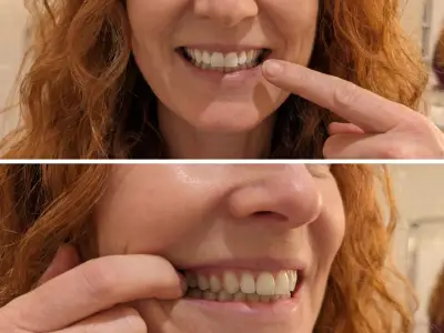 83p-a-day gum serum praised for easing bleeding gums in days