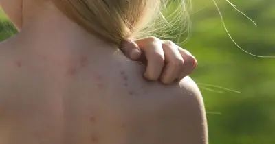 Bedbug alert as infestations hit hotels, trains and planes