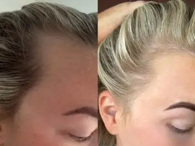 Boots £22 hair tonic 'leaves hair so thick' fans say