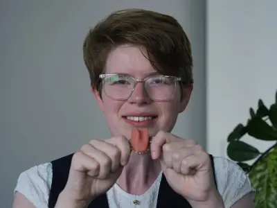 Cancer survivor first to get new artificial tongue on NHS