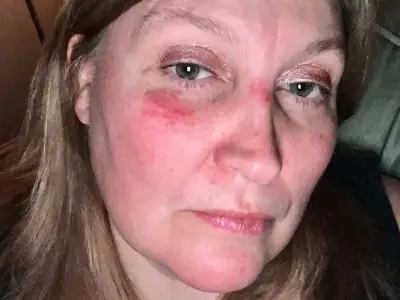 Good Samaritan's Act Leaves Trainer Facing £10,000 Surgery Bill