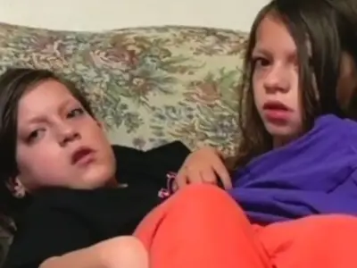 Mum of conjoined twins admits nerves over their future