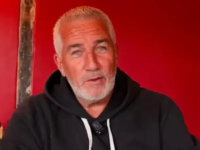 Paul Hollywood to undergo surgery for severe Carpal Tunnel Syndrome