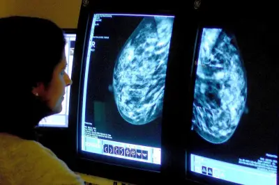 Seven cancers rising in under-50s, experts warn