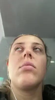 Woman with narcolepsy says condition treated as a joke