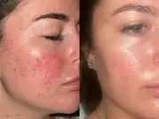 £29 serum 'completely changed' woman's winter skin, 'light makeup' now
