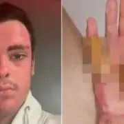Apprentice welder wins payout after 'human fireball' accident