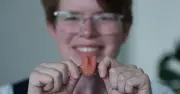 Cancer survivor given artificial tongue in NHS first