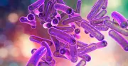 Drug-resistant Shigella cases rise in US, raising health concerns