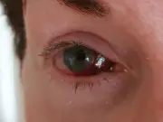 Woman left almost blind after botched eye op 'felt like being tortured'