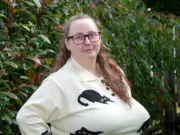 Woman with 12lb breasts denied NHS reduction turns to crowdfunding